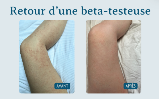Sérum Aqueux Apaisant - Phase Enflammée (50mL)